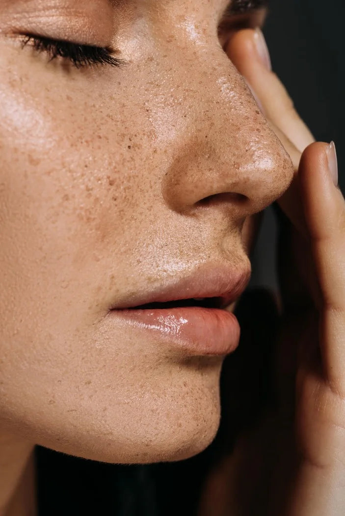 Close-up of freckled skin